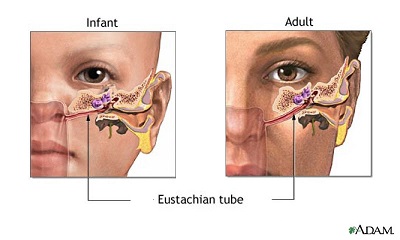 *The anatomy of the nasopharynx, Eustachian tube and middle ear in children. From* [*A.D.A.M.*](http://aia5.adam.com/content.aspx?productId=117&pid=1&gid=000638)